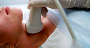 screening tiroideo scalea